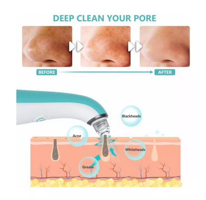 EXTRACTOR DE ESPINILLAS