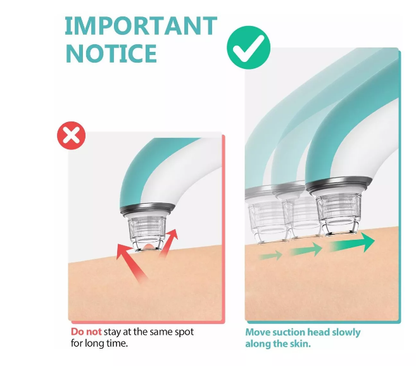 EXTRACTOR DE ESPINILLAS
